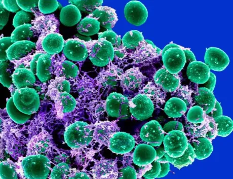 staph bacteria